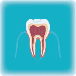 Root Canal Treatment
