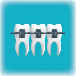 Dental Braces